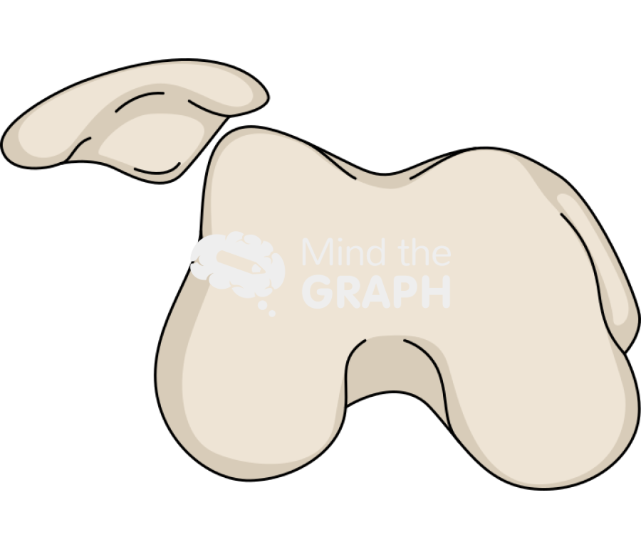 Patella dislocation 2 Icons, Symbols, Pictures, and Images