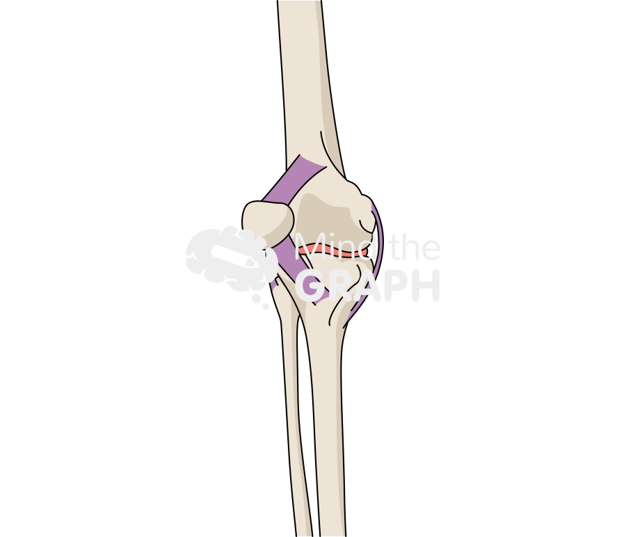 Patella dislocation bone full Icons, Symbols, Pictures, and Images
