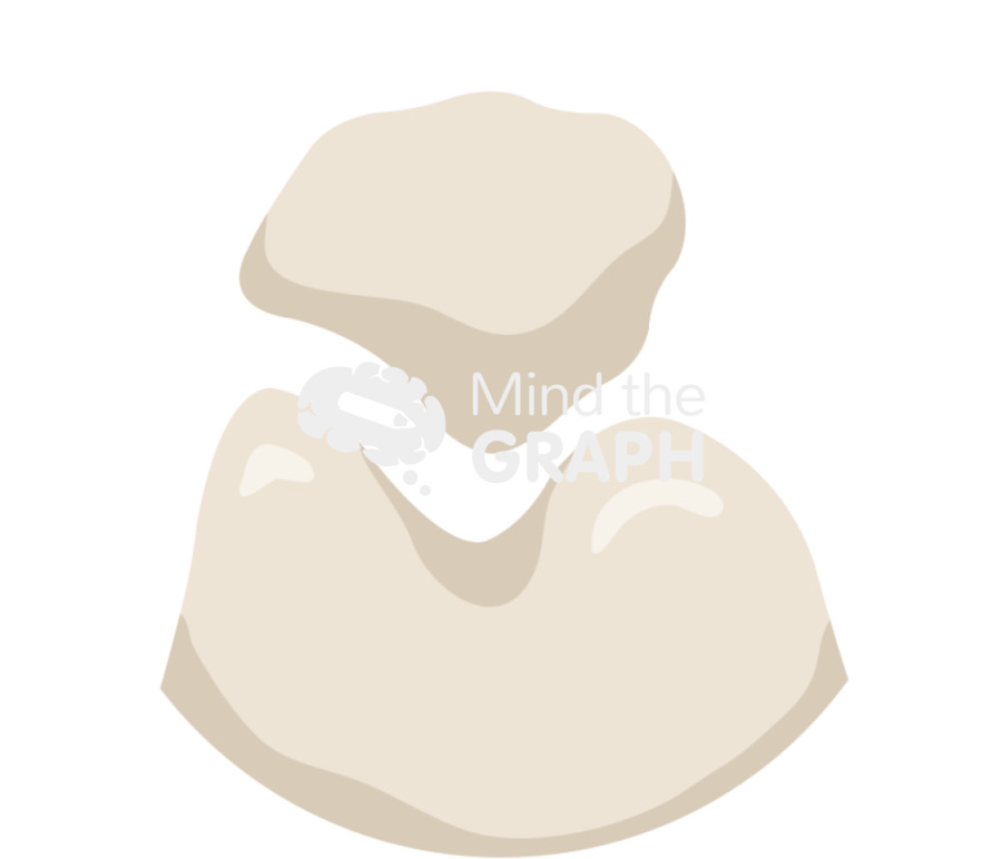 Patellofemoral arthritis classificiation stage1 zoom Icons, Symbols, Pictures, and Images