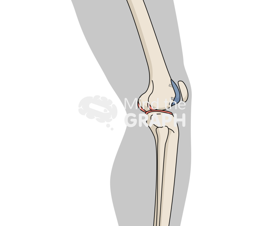 Patellofemoral joint knee lateral onlay body Icons, Symbols, Pictures, and Images