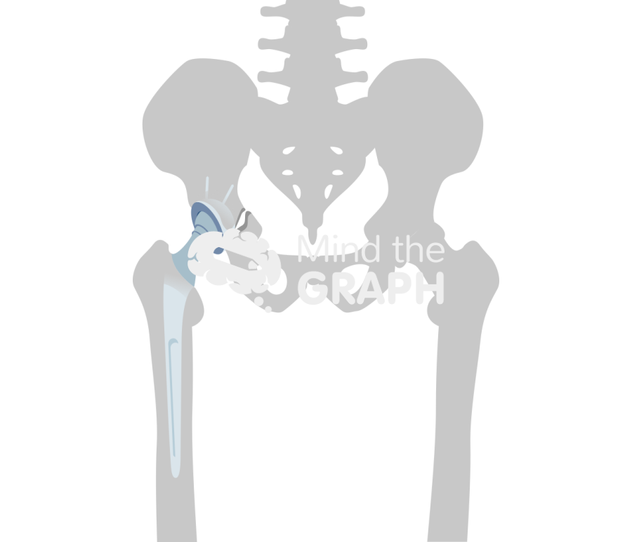 Pelvic discontinuity bone Icons, Symbols, Pictures, and Images