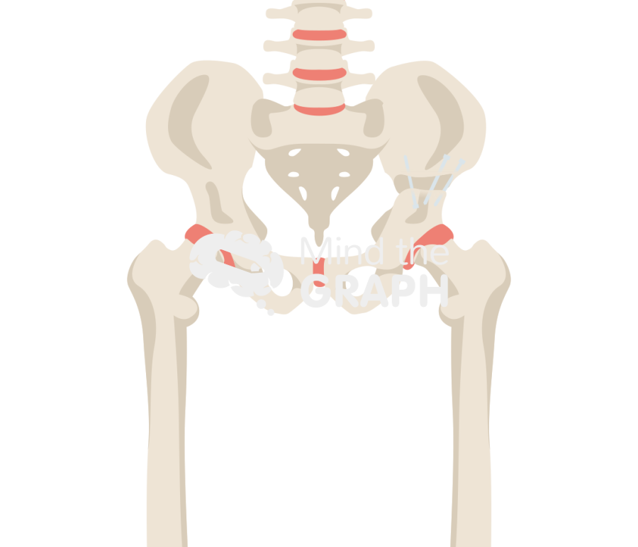 Pelvic osteotomy bone full Icons, Symbols, Pictures, and Images