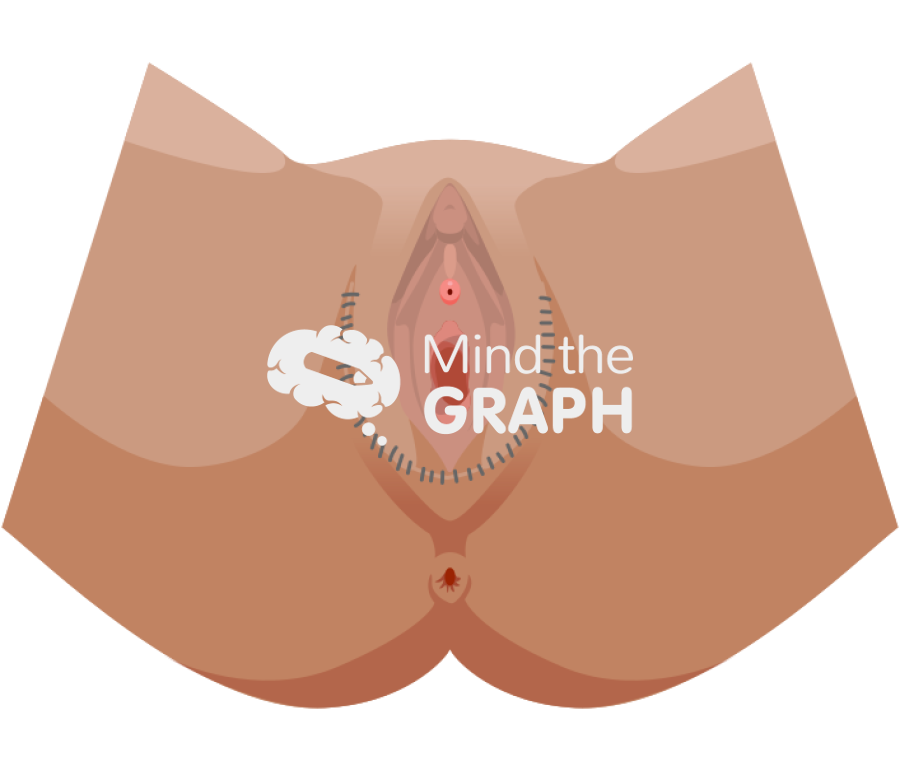 Penile inversion vaginoplasty Icons, Symbols, Pictures, and Images