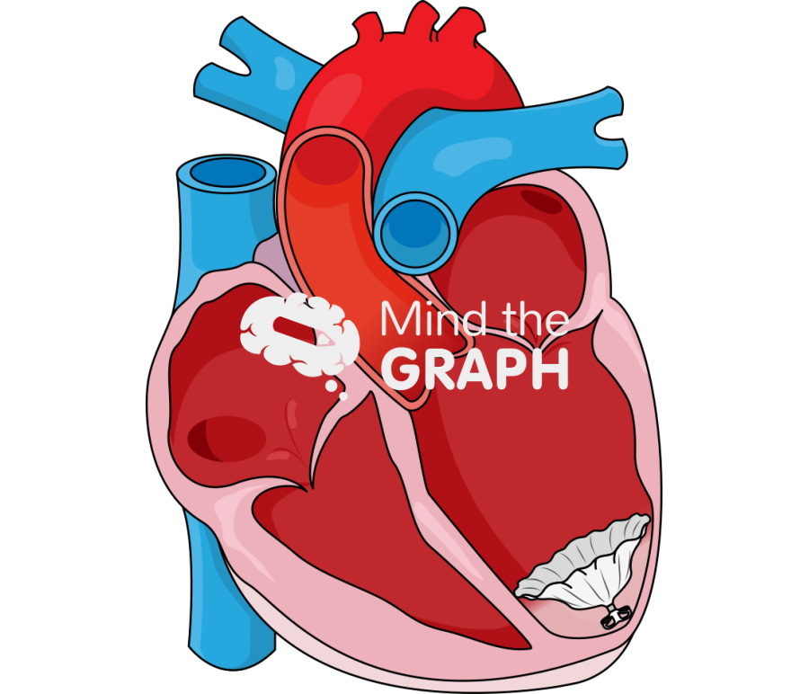 Percutaneous ventricular restoration parachute device Icons, Symbols, Pictures, and Images
