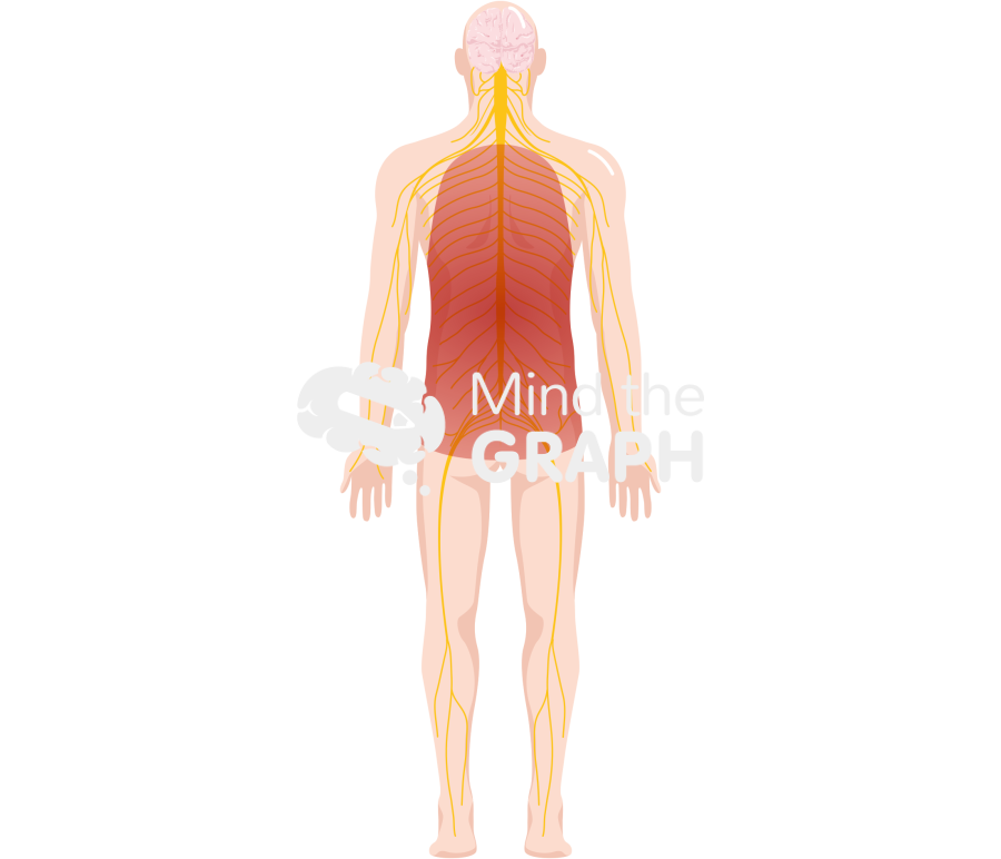 Peripheral neuropathy body full Icons, Symbols, Pictures, and Images