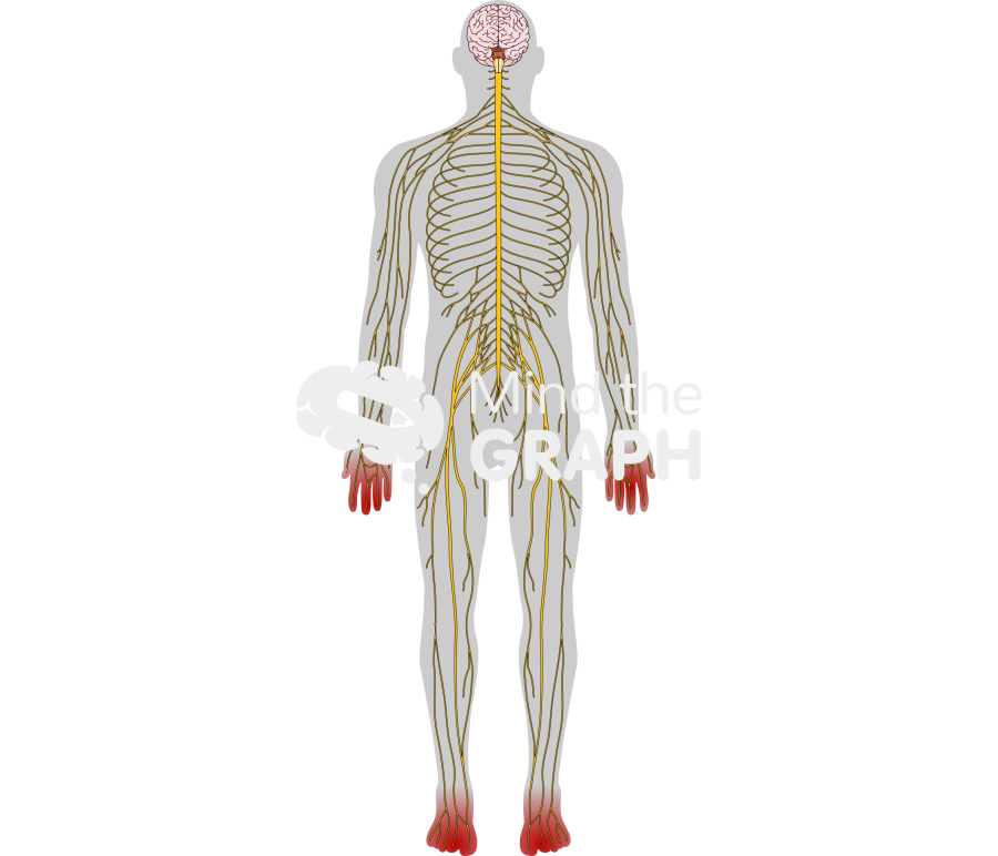 Peripherical neuropathy human shape Icons, Symbols, Pictures, and Images