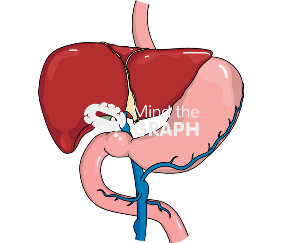 Portal hypertension Icons, Symbols, Pictures, and Images