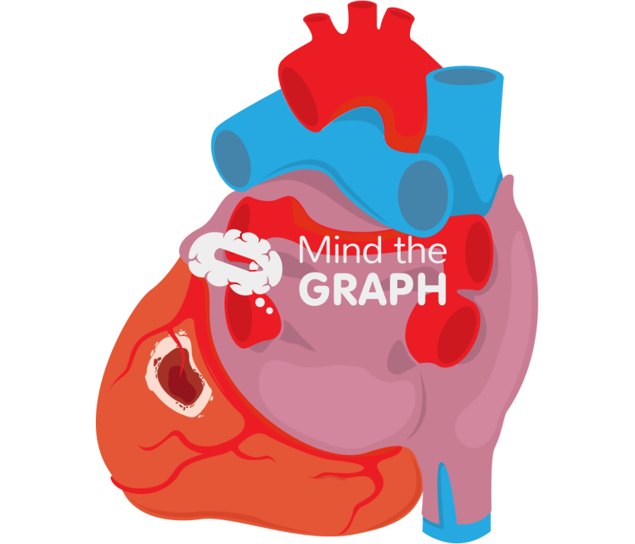 Posterobasal infarct Icons, Symbols, Pictures, and Images