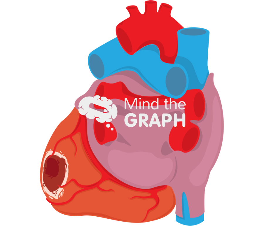 Posterolateral infarct Icons, Symbols, Pictures, and Images