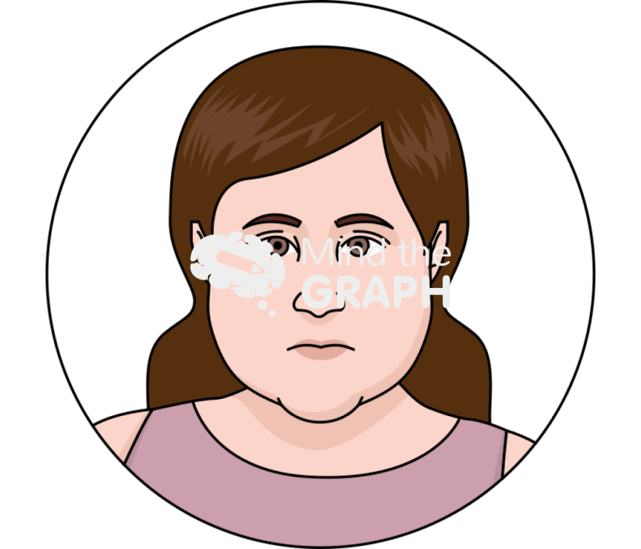 Prader willi facial dysmorphisms Icons, Symbols, Pictures, and Images