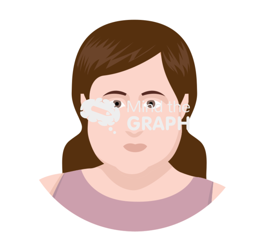 Prader willi facial dysmorphisms Icons, Symbols, Pictures, and Images