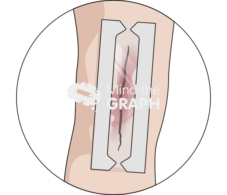 Prineo skin closure system Icons, Symbols, Pictures, and Images