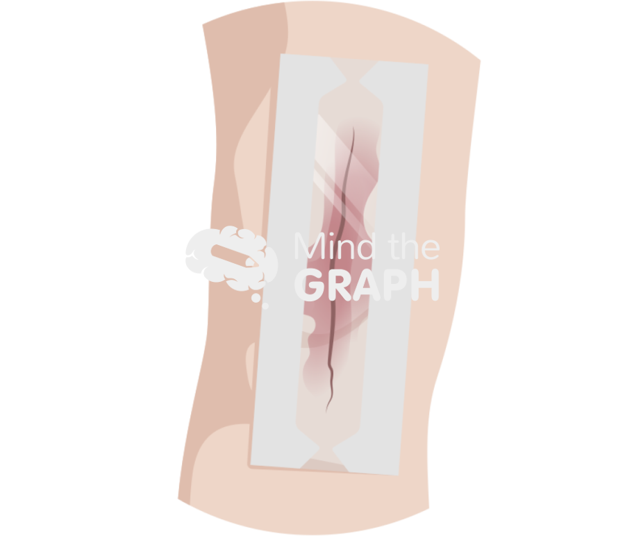 Prineo skin closure system Icons, Symbols, Pictures, and Images