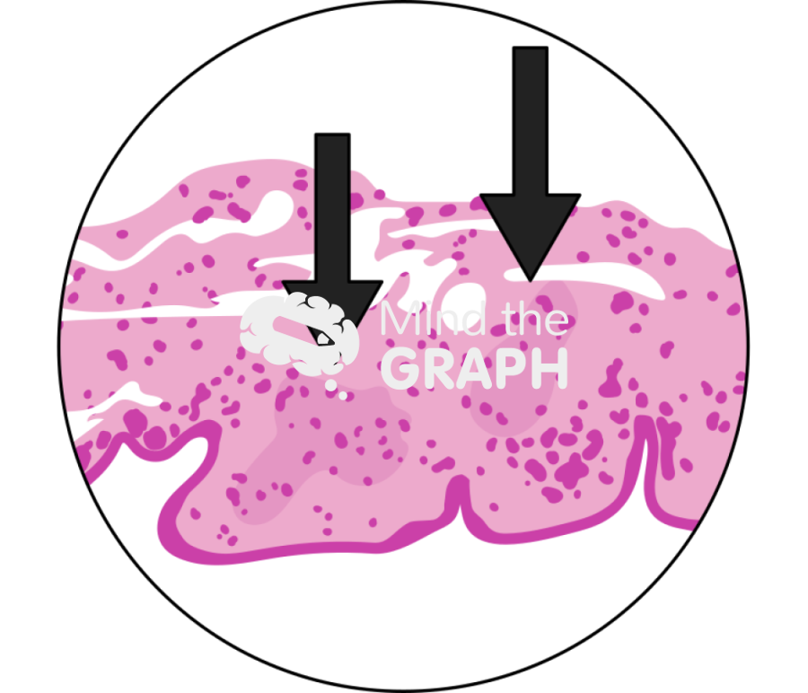 Progression of the neck partial regeneration pga 6 months zoom Icons, Symbols, Pictures, and Images