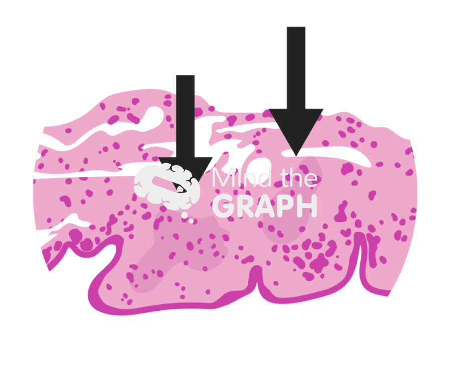Progression of the neck partial regeneration pga 6 months zoom Icons, Symbols, Pictures, and Images