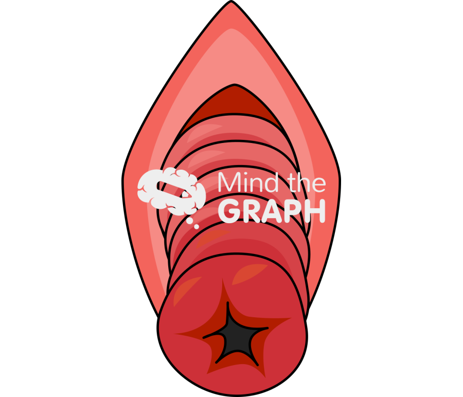 Prolapse front view Icons, Symbols, Pictures, and Images