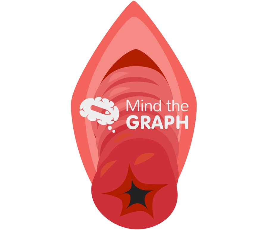 Prolapse front view Icons, Symbols, Pictures, and Images