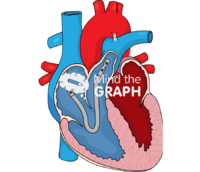 Protekduo cannula for ecmo - Edit and Customize Icons of Protekduo cannula for ecmo Protekduo cannula for ecmo Icons, Symbols, Pictures, and Images