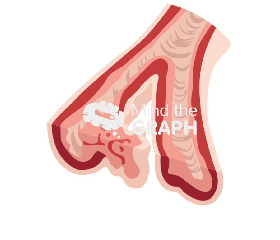 Pulmonary arterial hypertension zoom Icons, Symbols, Pictures, and Images