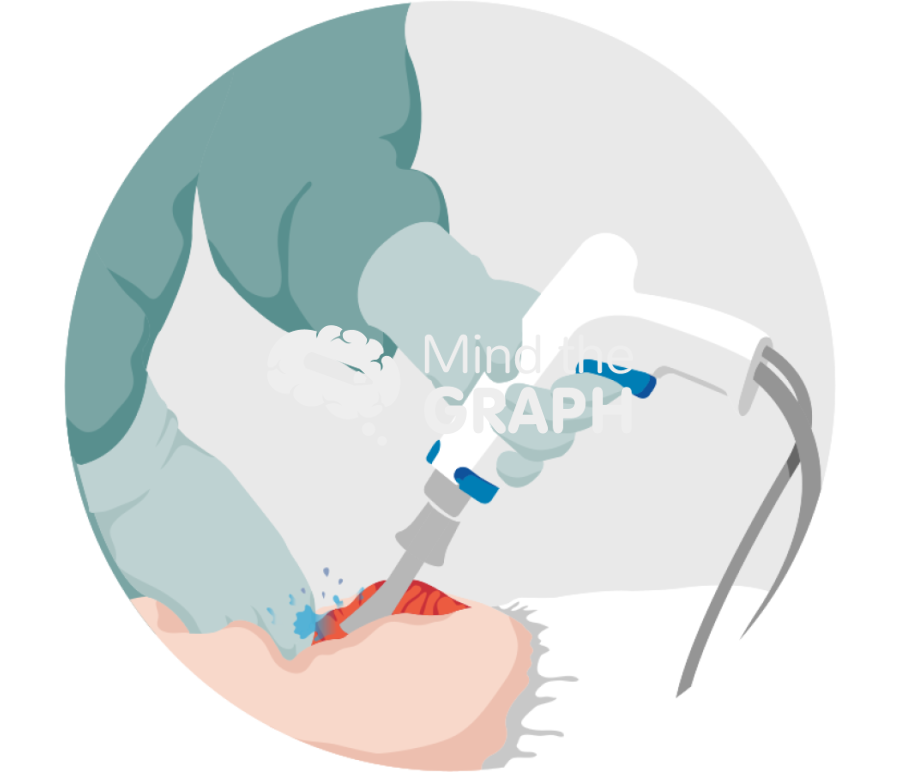 Pulse lavage zoom Icons, Symbols, Pictures, and Images