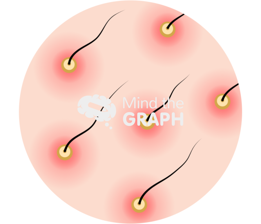 Pyogenic folliculitis zoom Icons, Symbols, Pictures, and Images