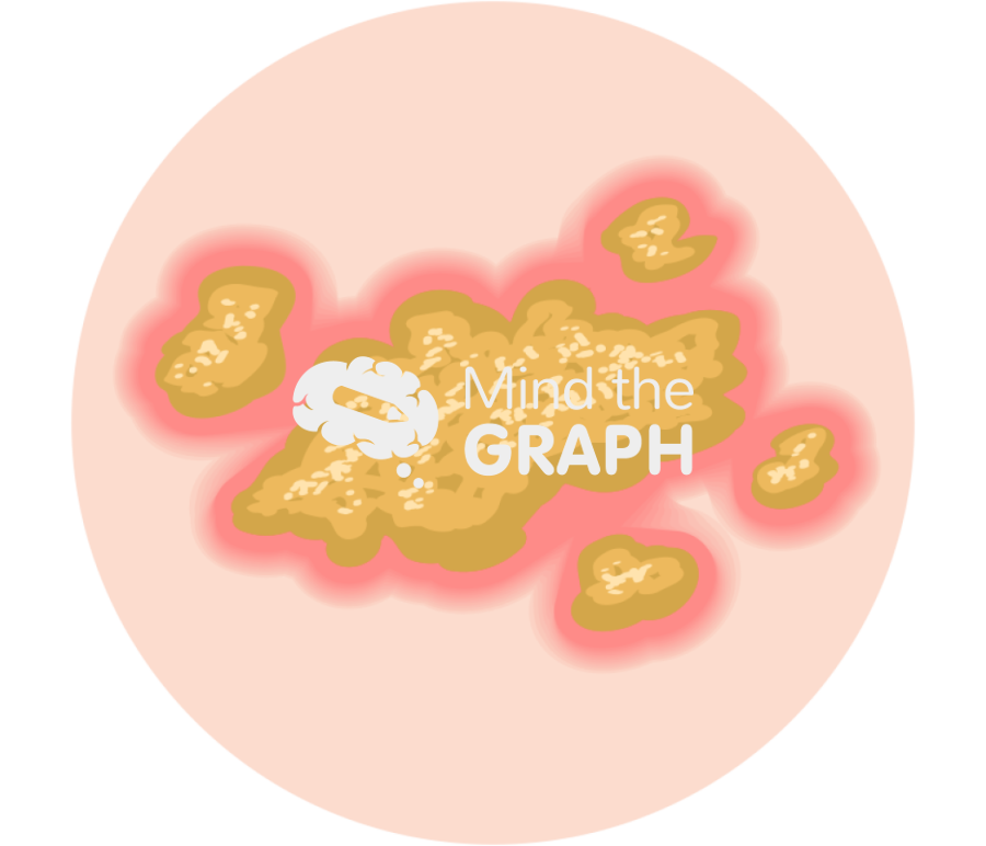 Pyogenic infection impetigo zoom Icons, Symbols, Pictures, and Images