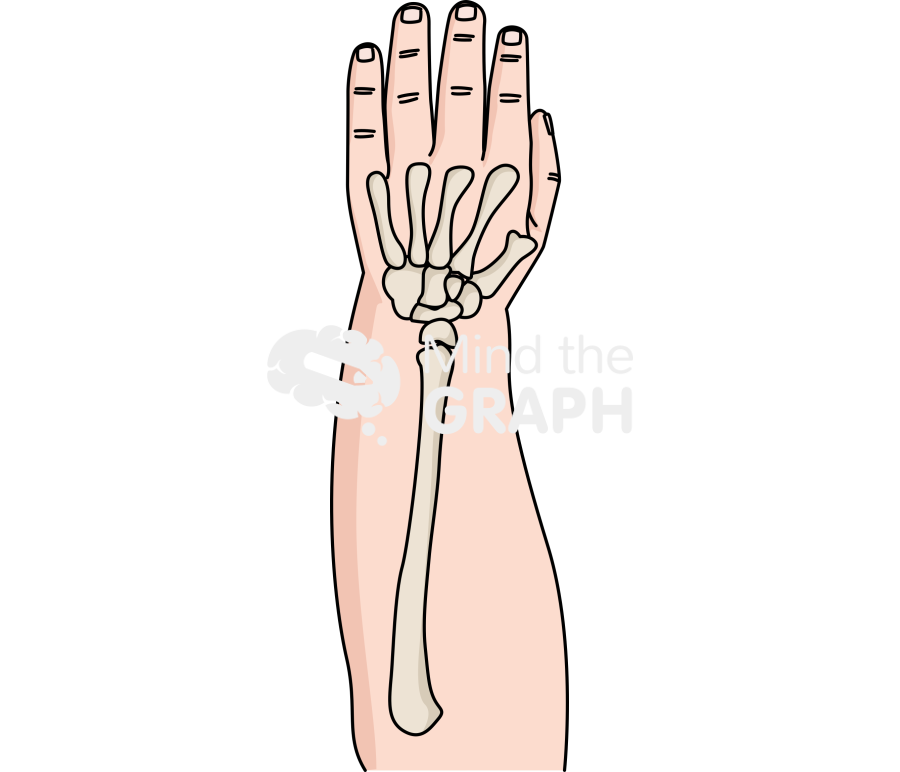 Radial aplasia treatments centralization Icons, Symbols, Pictures, and Images