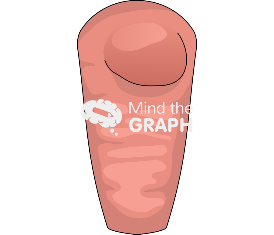 Radiation treatment rectal 1 Icons, Symbols, Pictures, and Images