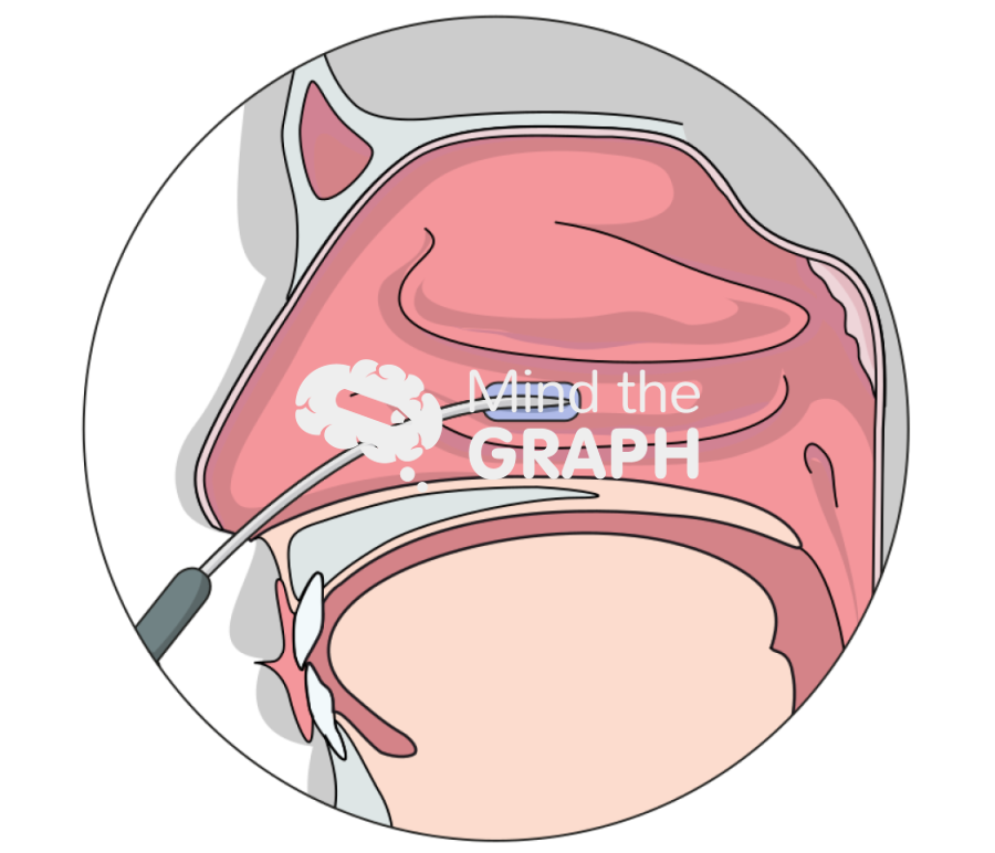 Radiofrequency lower concha Icons, Symbols, Pictures, and Images