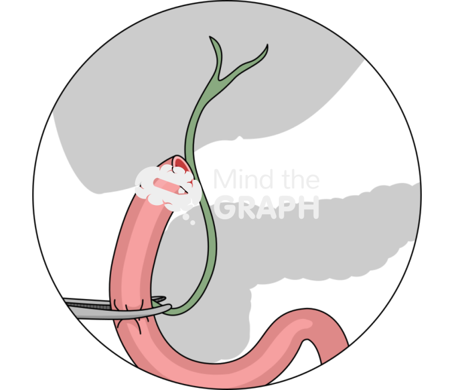 Rat clamped duodenum bile duct zoom Icons, Symbols, Pictures, and Images