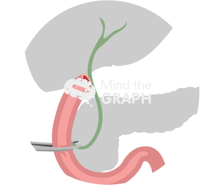 Rat clamped duodenum bile duct zoom Icons, Symbols, Pictures, and Images