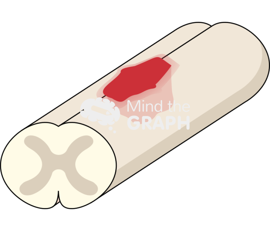 Rat injured spinal cord Icons, Symbols, Pictures, and Images