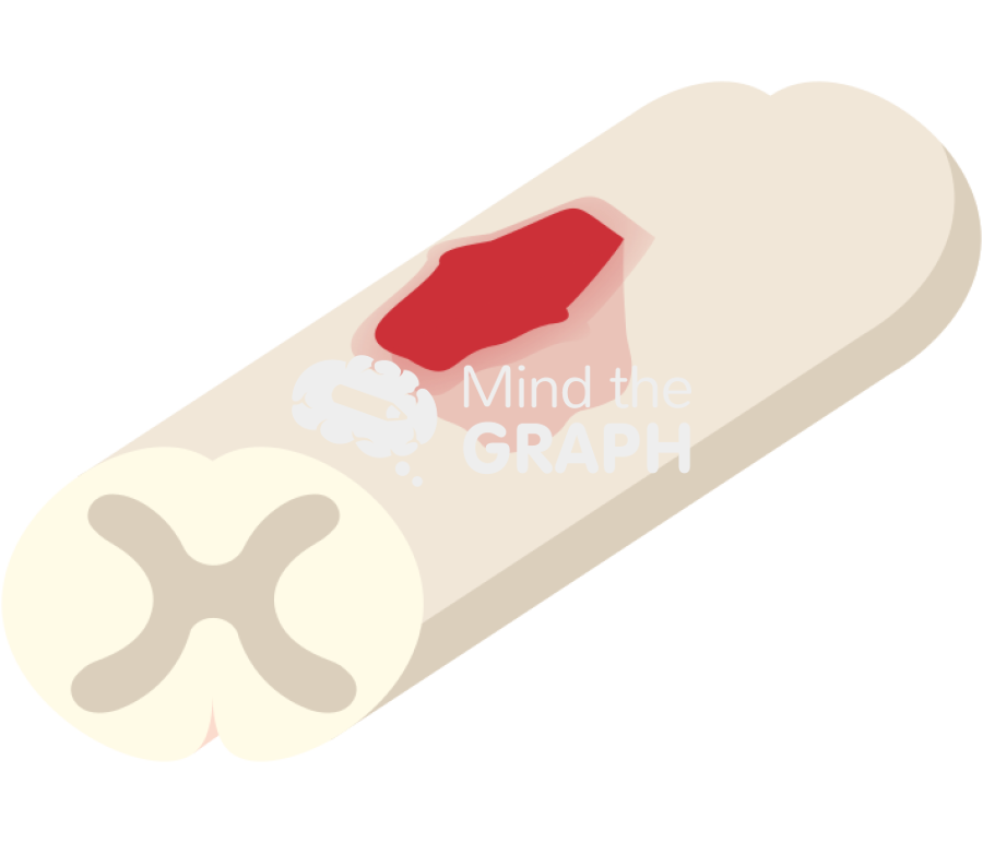 Rat injured spinal cord Icons, Symbols, Pictures, and Images