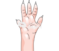 Rat paw edema Icons, Symbols, Pictures, and Images