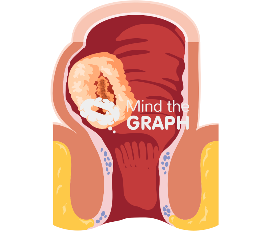 Rectal cancer internal Icons, Symbols, Pictures, and Images