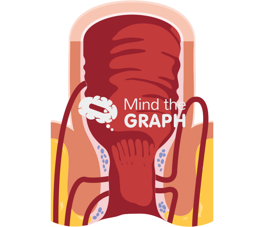 Rectum anal fistula Icons, Symbols, Pictures, and Images