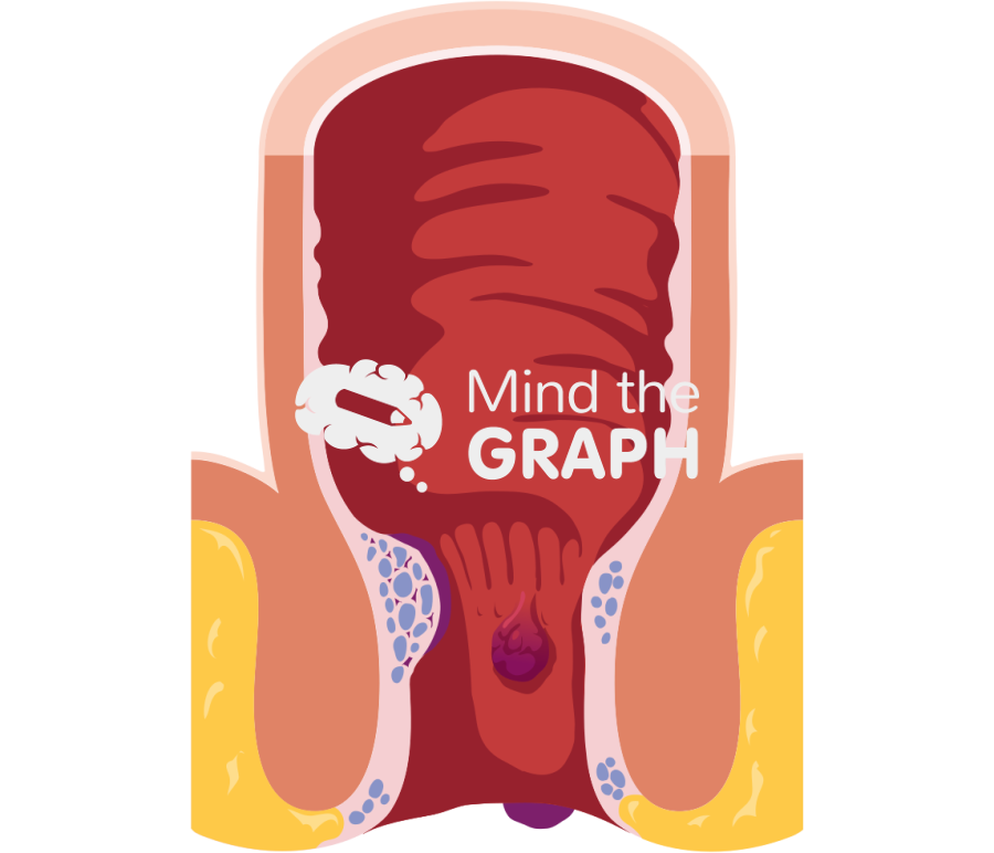 Rectum nternal external hemorrhoids Icons, Symbols, Pictures, and Images