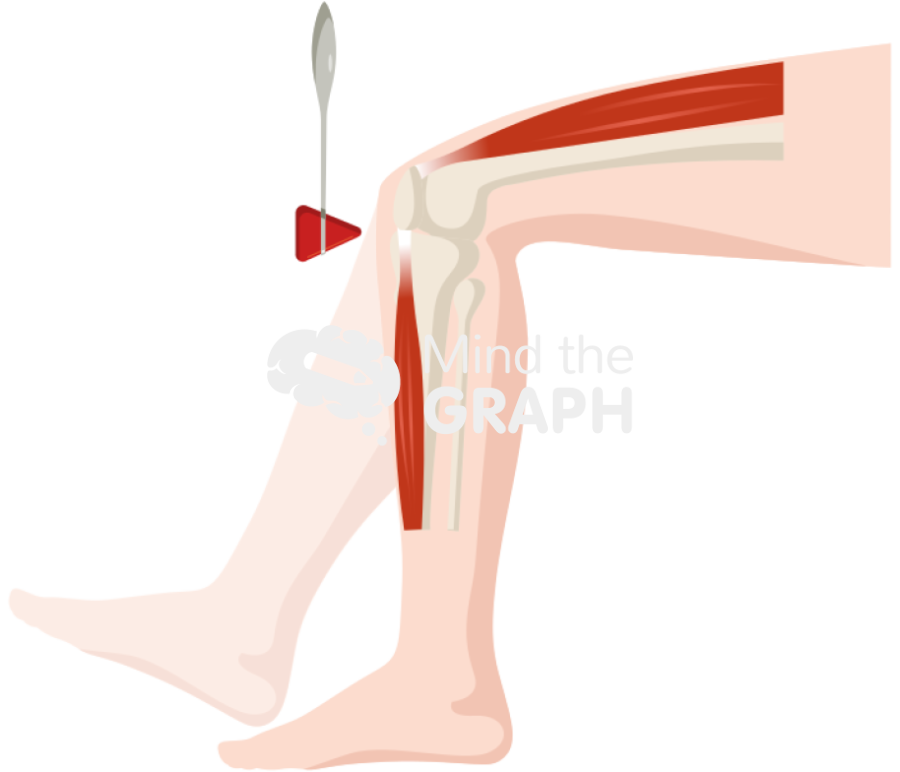 Reflex exam leg knee lateral Icons, Symbols, Pictures, and Images