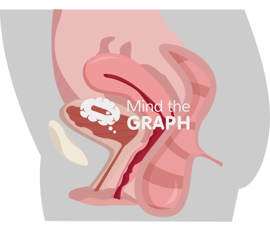 Retocele Icons, Symbols, Pictures, and Images