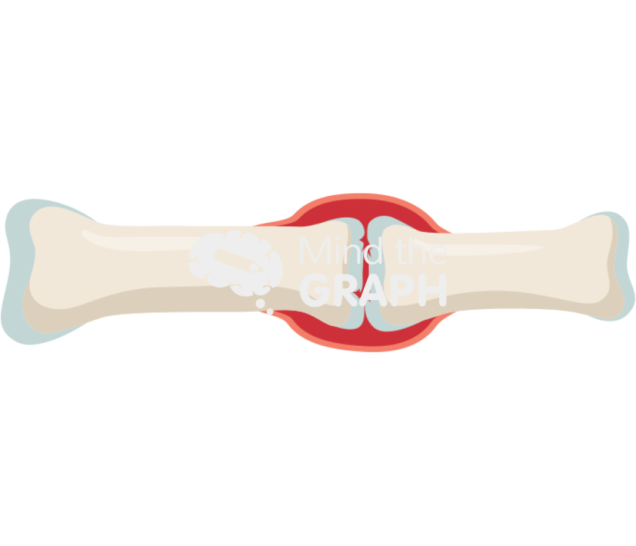 Rheumatoid arthritis bone Icons, Symbols, Pictures, and Images