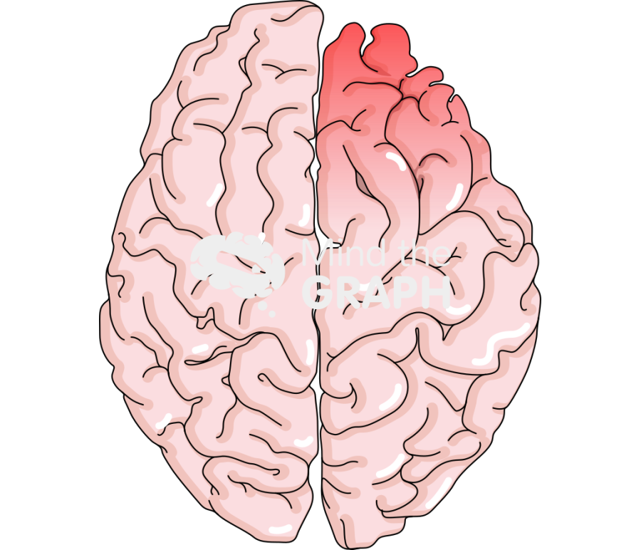 Right hemisphere hypo activated schizophrenia Icons, Symbols, Pictures, and Images