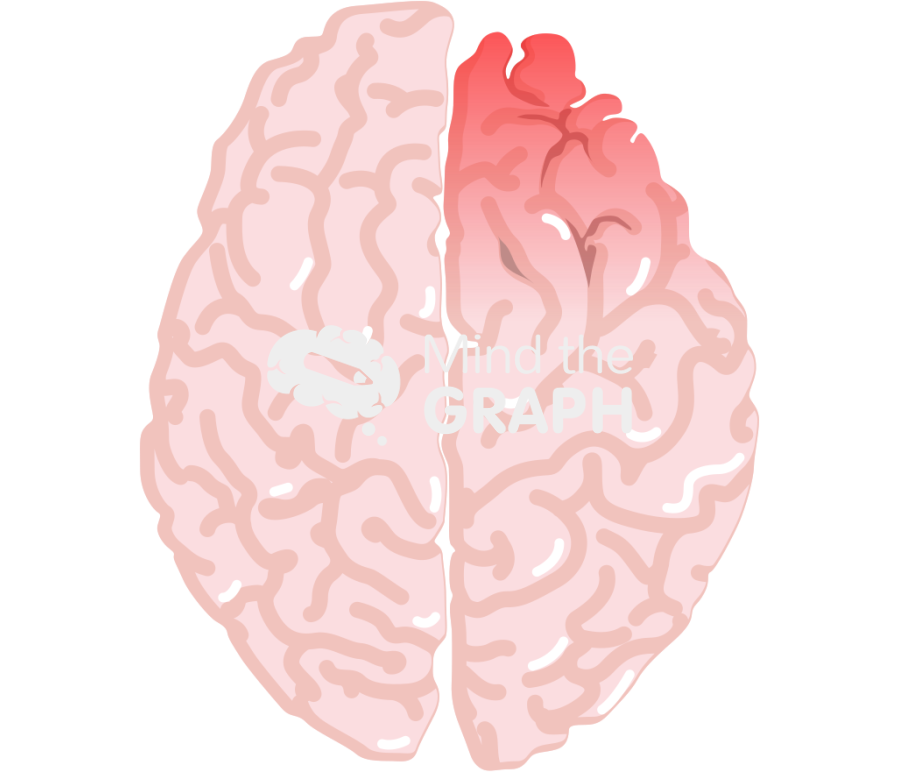 Right hemisphere hypo activated schizophrenia Icons, Symbols, Pictures, and Images