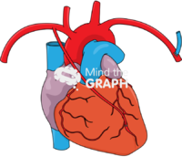 Right internal mammary artery contralateral arteriovenous fistula Icons, Symbols, Pictures, and Images