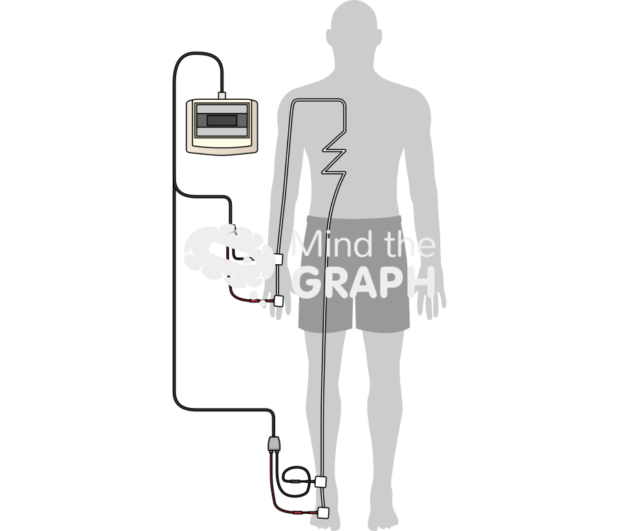 Rjl four electrodes wrist ankle same side body Icons, Symbols, Pictures, and Images