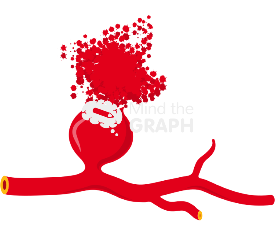 Saccular aneurysm open Icons, Symbols, Pictures, and Images