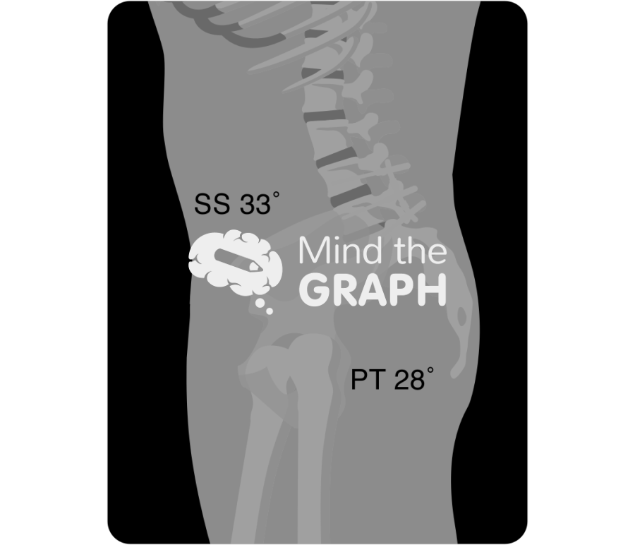 Sacral slope pelvic tilt after spinal fusion x ray Icons, Symbols, Pictures, and Images