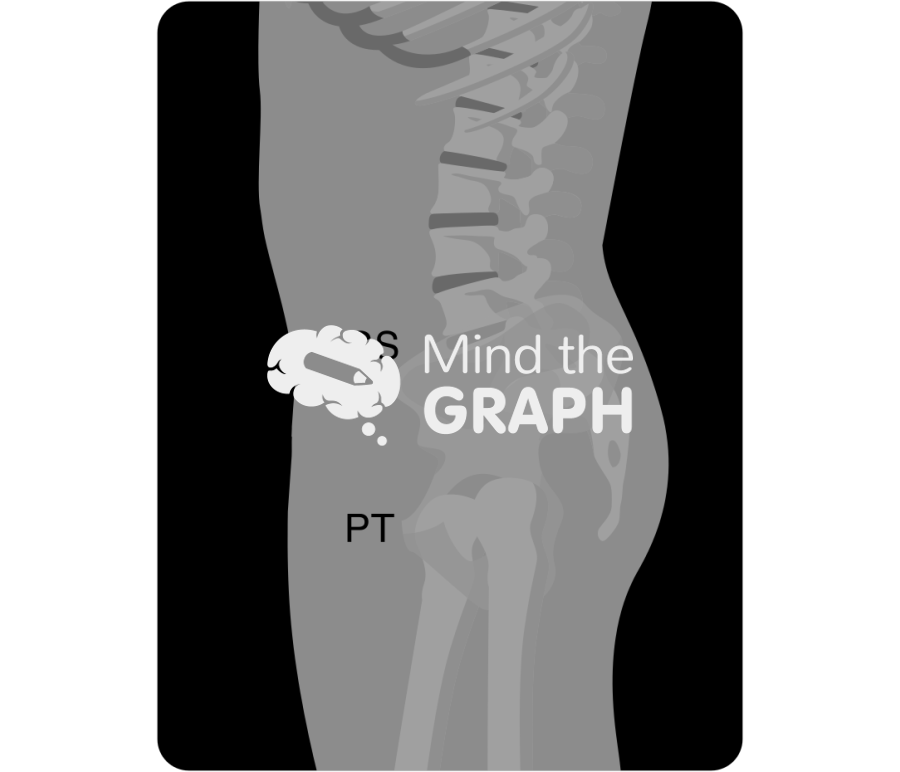 Sacral slope pelvic tilt x ray Icons, Symbols, Pictures, and Images