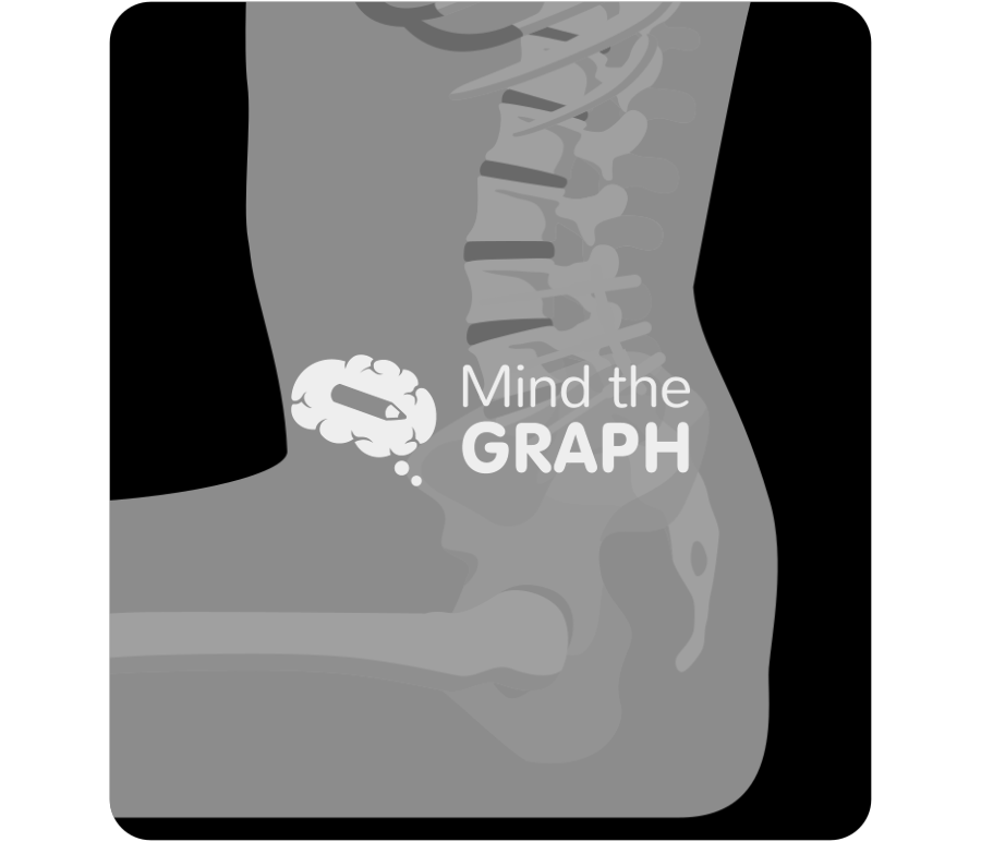 Sacral slope sitting after spinal fusion x ray