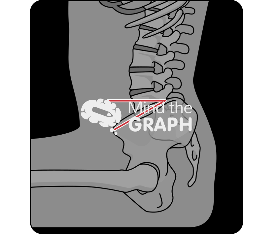 Sacral slope sitting x ray Icons, Symbols, Pictures, and Images