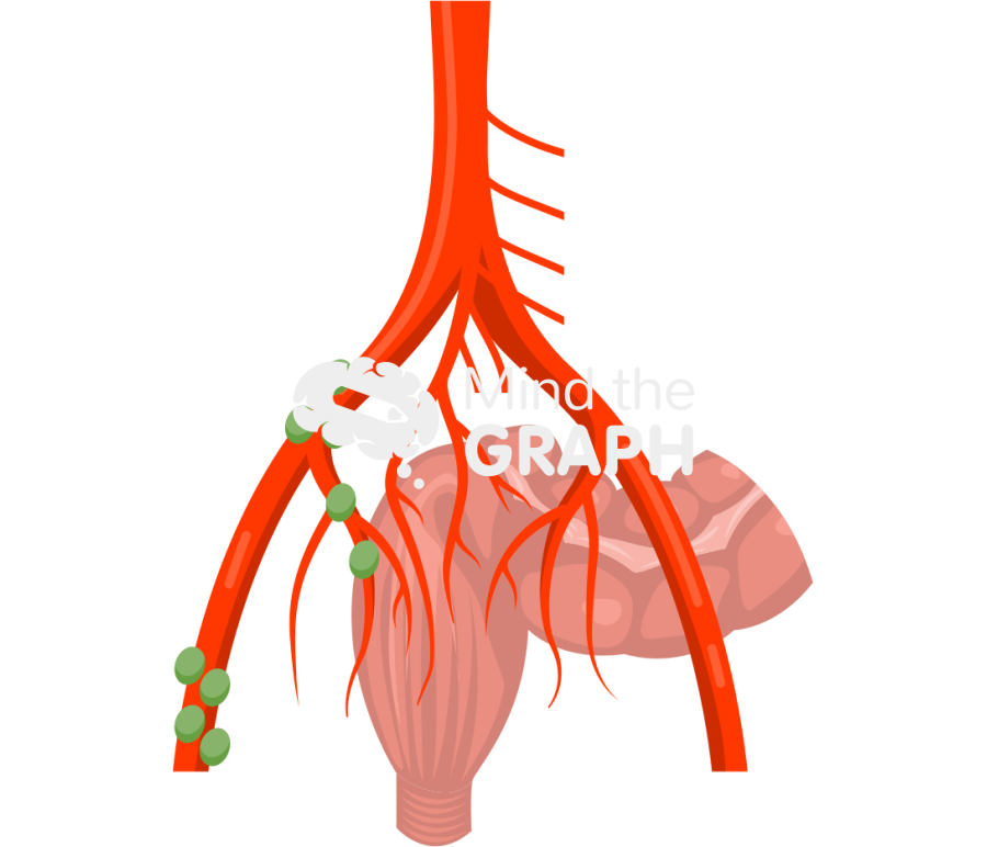 Schematic representation pelvic left lymph node Icons, Symbols, Pictures, and Images